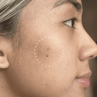 Mighty Patch™ for Dark Spots - Outdoor Ready