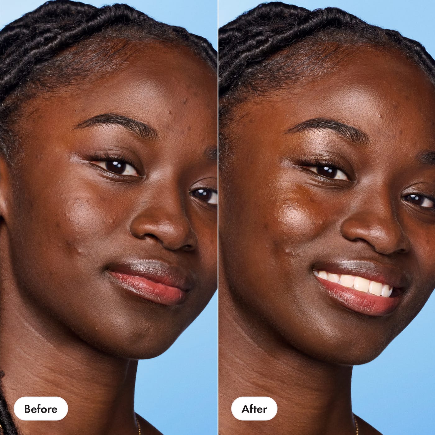 Glow Balm - Travel Choice